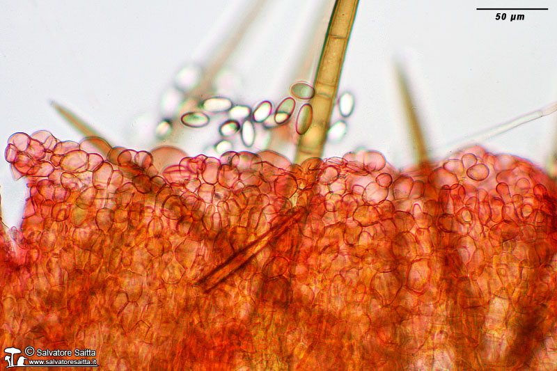 Cheilymenia stercorea excipulum ectale foto 1