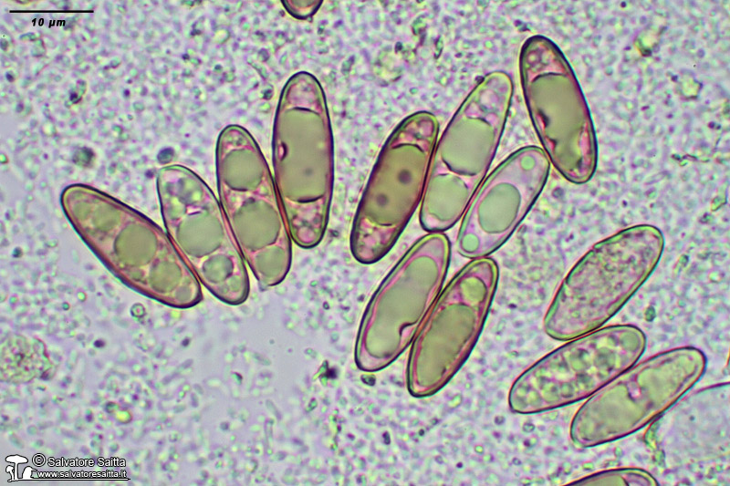 Chroogomphus subfulmineus spore foto 1