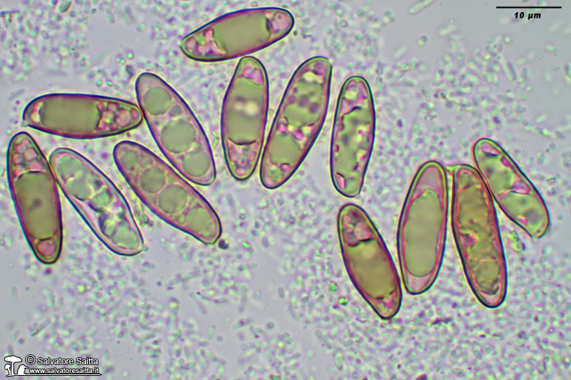 Chroogomphus subfulmineus spore foto 2