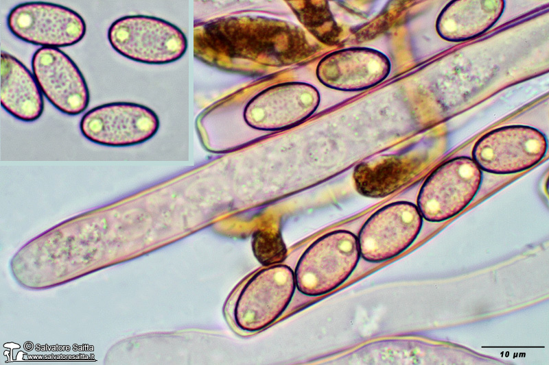 Geoscypha tenacella aschi, parafisi e spore foto 2