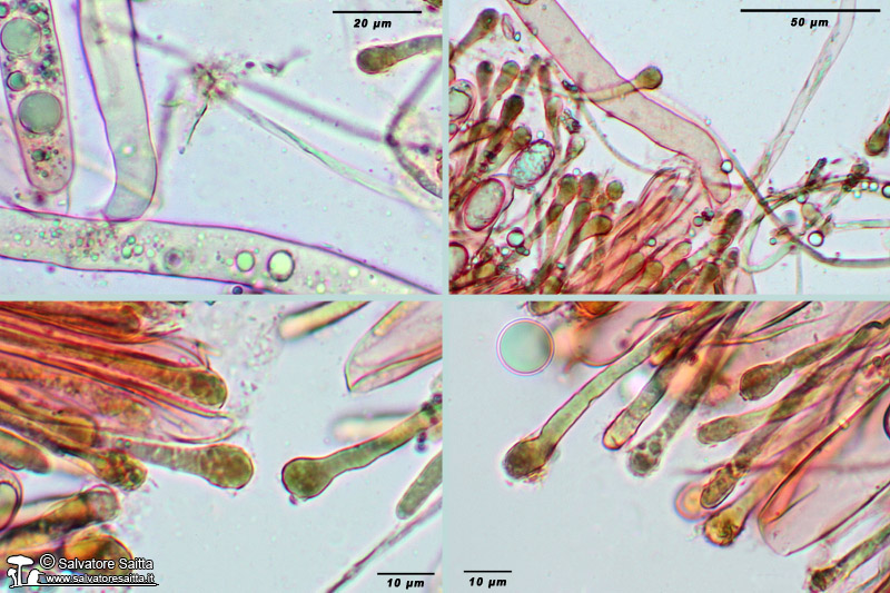 Helvella leucomelaena aschi aporinchi e apice parafisi foto 1