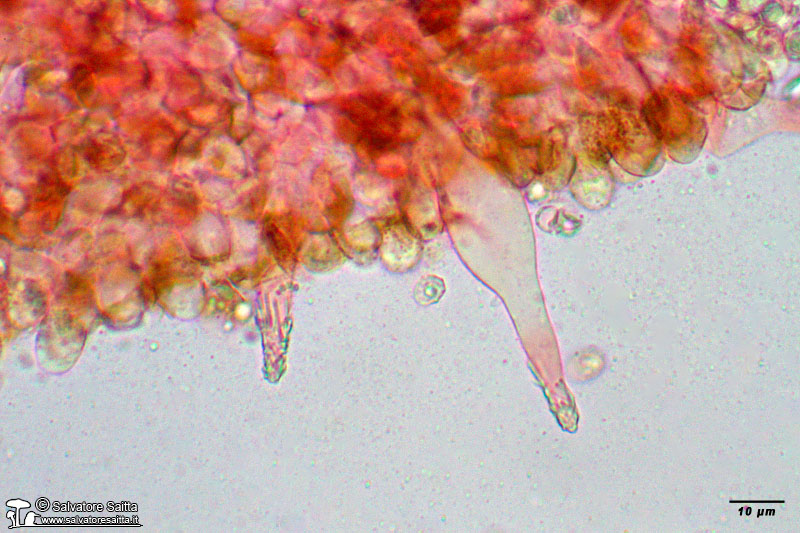 Melanoleuca polioleuca cheilocistidi foto 1