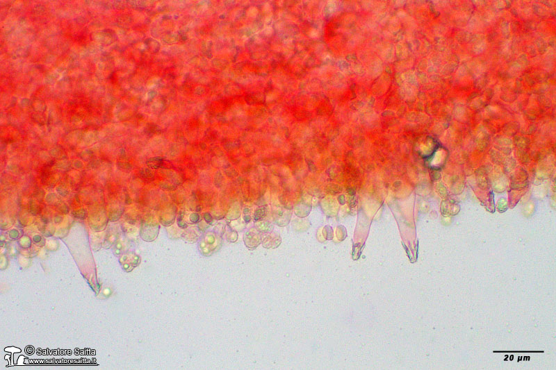 Melanoleuca polioleuca cheilocistidi foto 2