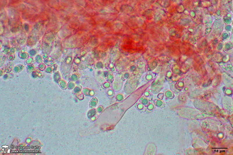 Melanoleuca polioleuca cheilocistidi foto 3