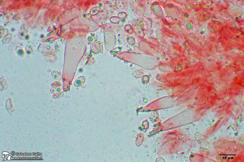 Melanoleuca polioleuca cheilocistidi foto 4