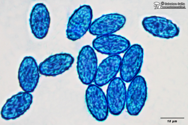 Peziza muscicola spore foto 4