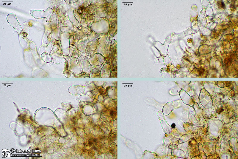 Peziza phyllogena excipulum ectale foto 2