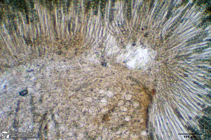 Peziza saccardoana excipulum foto 2