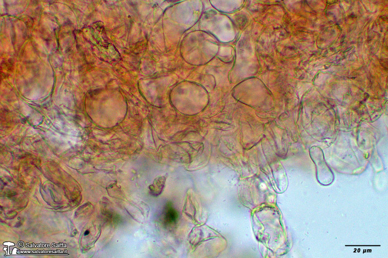 Peziza saccardoana excipulum foto 6