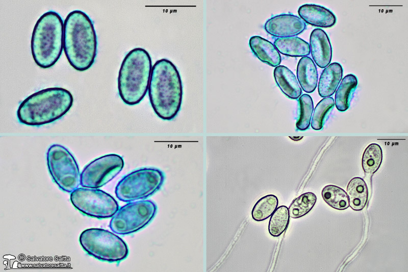 Peziza subviolacea spore foto 2