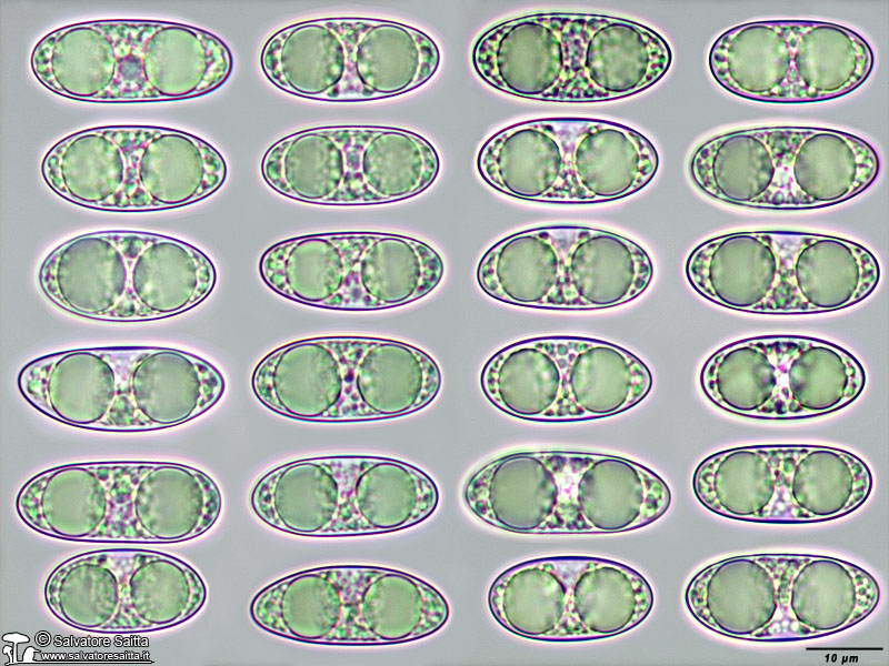 Tarzetta oblongispora spore foto 1